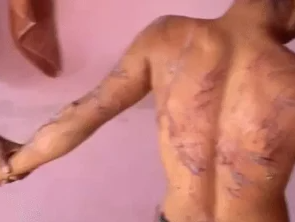 रायपुर में नशामुक्ति केंद्र की दरिंदगी! आदिवासी युवक को पाइप से पीटा