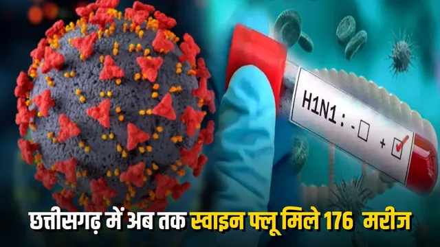 CG Swine Flu: छत्तीसगढ़ में H1N1 का बढ़ा खतरा, एक दिन में मिले 46 नए मरीज; रायपुर में सबसे ज्यादा केस